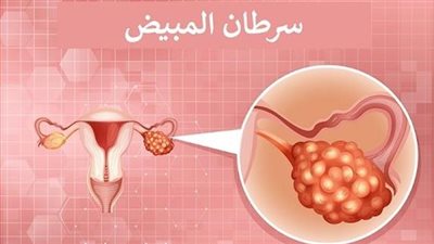 سر@طان المبيض