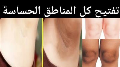 طرق طبيعية لتفتيح وتبييض المناطق الحساسة