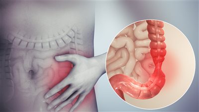 أعراض القولون العصبي وجرث@ومة المعدة وطرق علاجهما